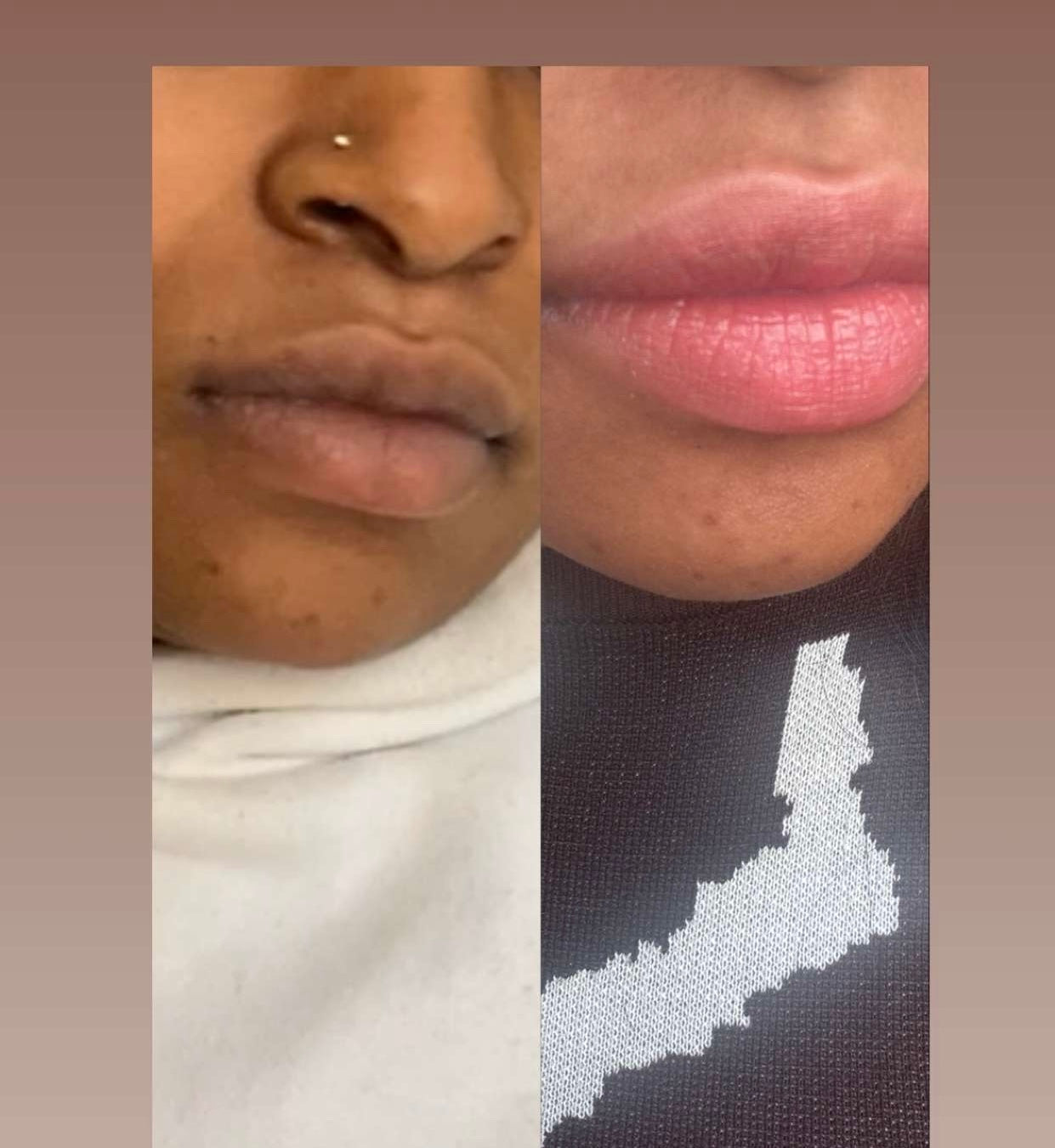 PINK LIPS
