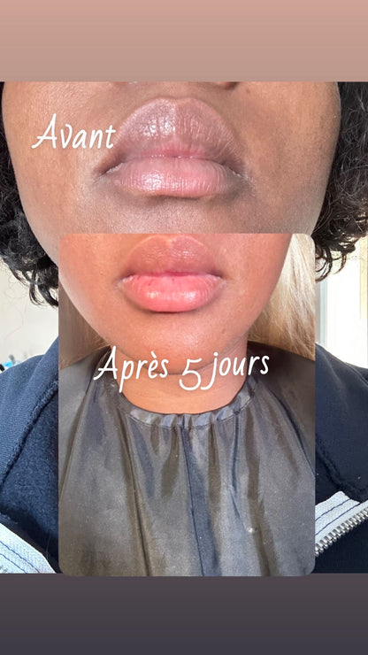 PINK LIPS